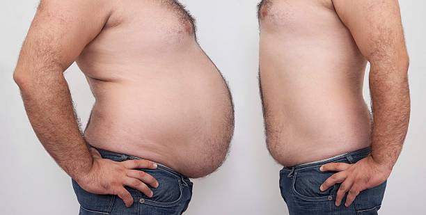 Which Weight Loss Clinic is Best for You?