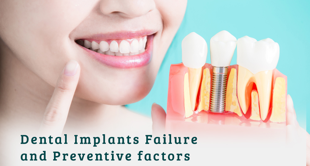 Dental Implants Failure  and Preventive factors
