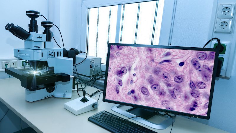 Digital Pathology Market Growth (Status and Outlook) 2019-2024