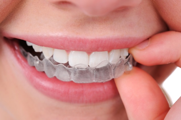 Clear Aligner Therapy Market Growth 2019-2024