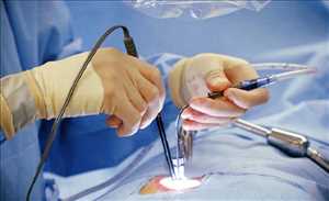 Spinal Implants and Surgical Devices Market Research Report 2018