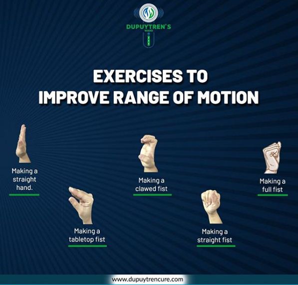 Best Hand Exercises For Dupuytren's Contracture - Dupuytrencure