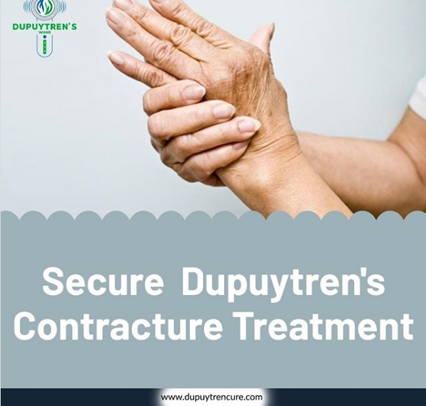 Secure Dupuytren's Contracture Treatment At Home