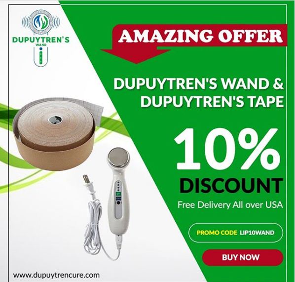 Dupuytren Contracture Therapy at home  - Dupuytrencure