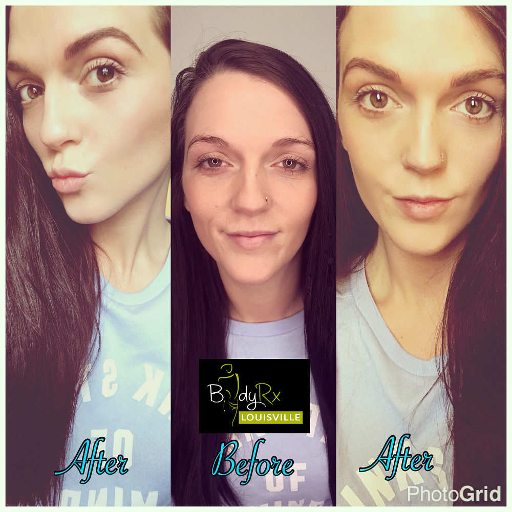 Before and After Photos Gallery | BodyRx