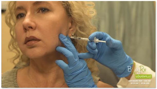 Botox Treatment Louisville, BodyRx