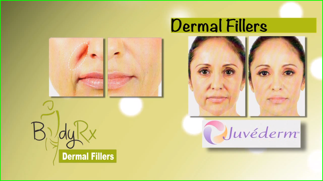 Face Fillers Louisville KY