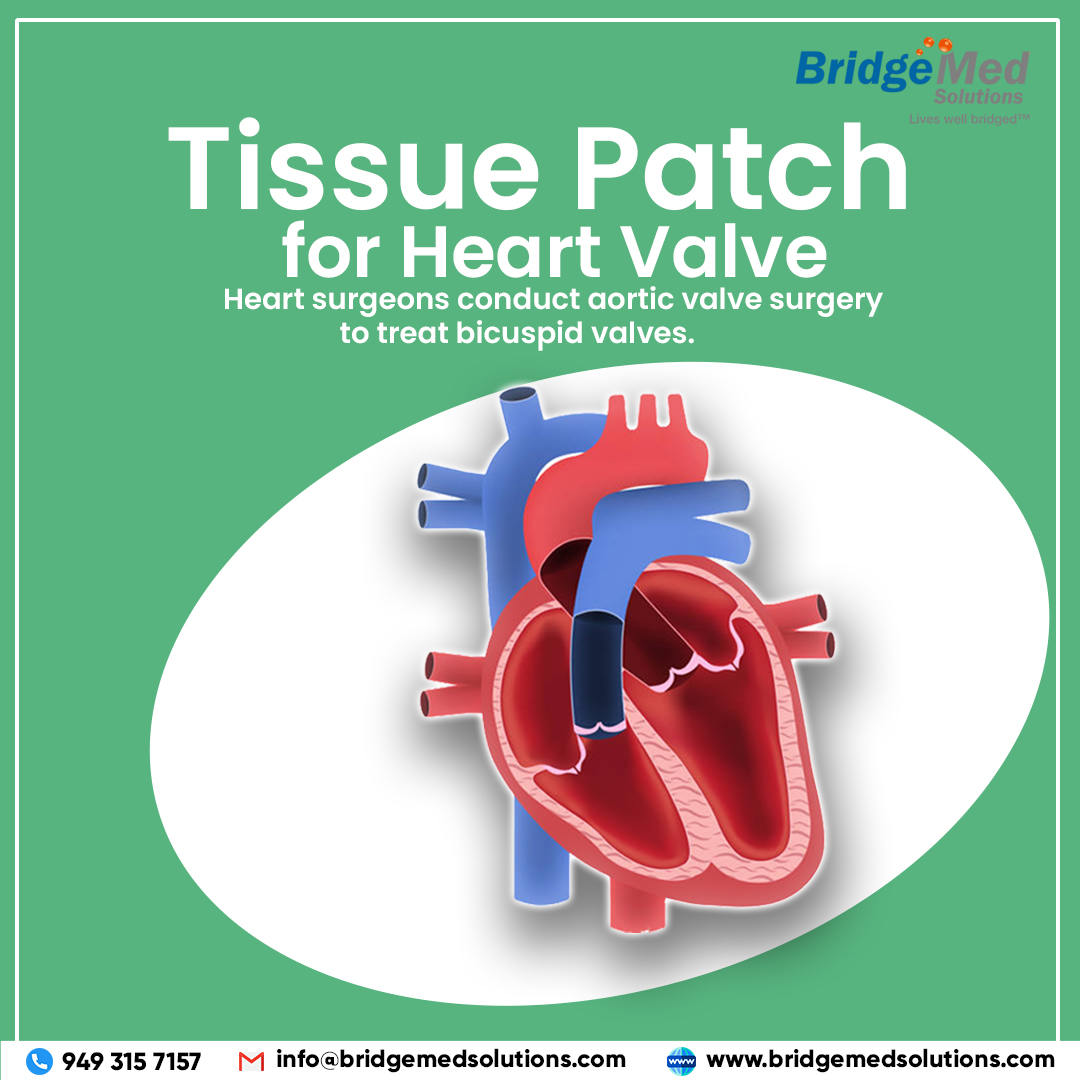 Tissue Patch for Heart Valve