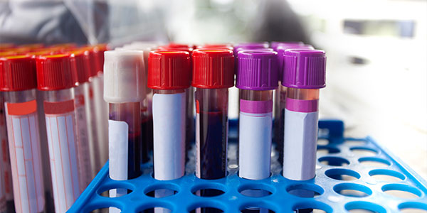 Liver Function Tests Market Professional Survey Report 2019
