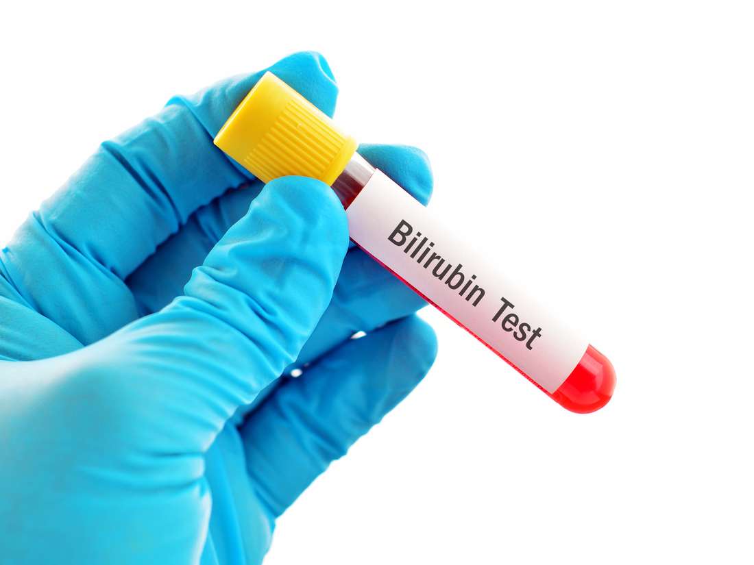 Bilirubin Blood Test Market Insights 2019
