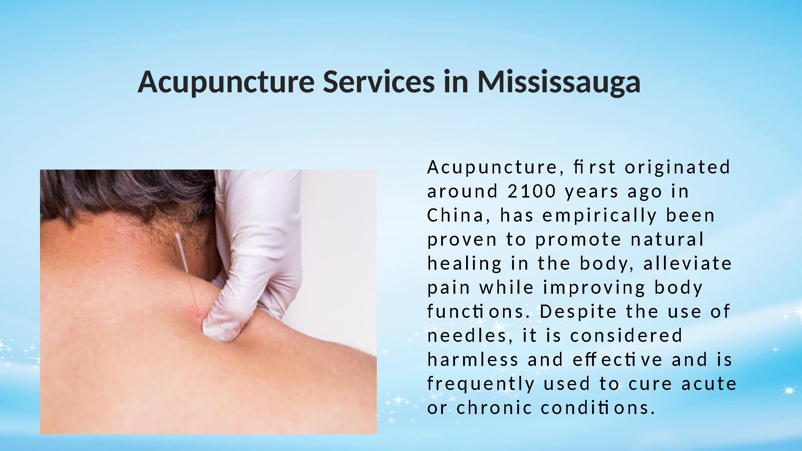 Acupuncture Services in Mississauga