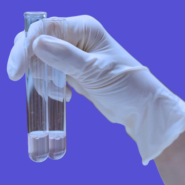 Acetic Acid Market Trends by Key Players, End User, Demand, Analysis Growth and Forecast 2030 - ChemAnalyst