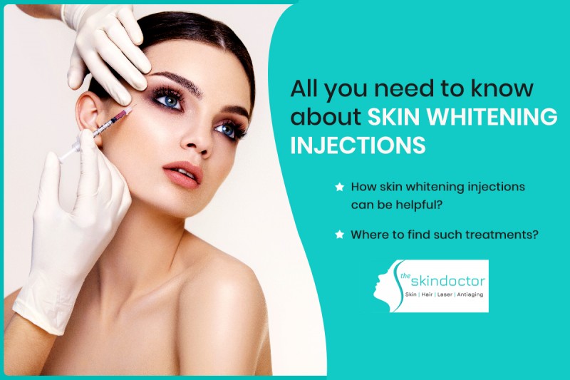 All you need to know about skin whitening injections