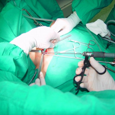 A Robotic Thyroid Surgeon in Delhi offers technologically advanced treatments