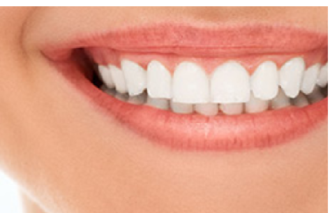 Smile Makeover Essendon - Dentist Essendon | Smile Makeover