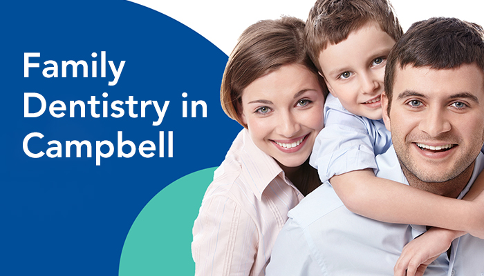 Best Cosmetic Dentistry in Campbell | Dental Services and Treatment
