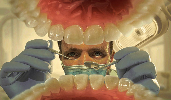 How Long Do Mini Dental Implants Last?