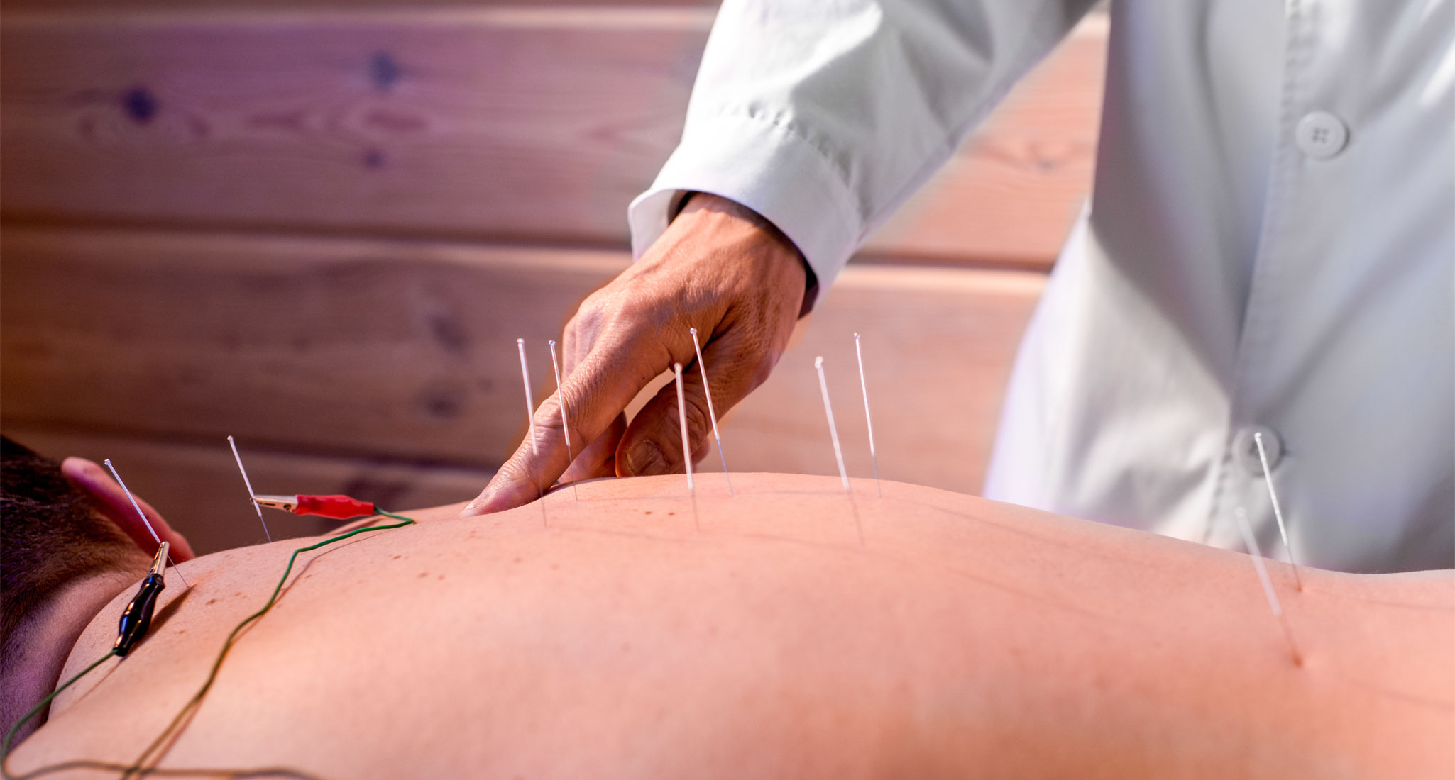 Looking KOSA Acupuncture for Back pain Gaithersburg MD