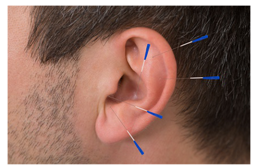 Best Professional Acupuncture Clinic Services in Gaithersburg