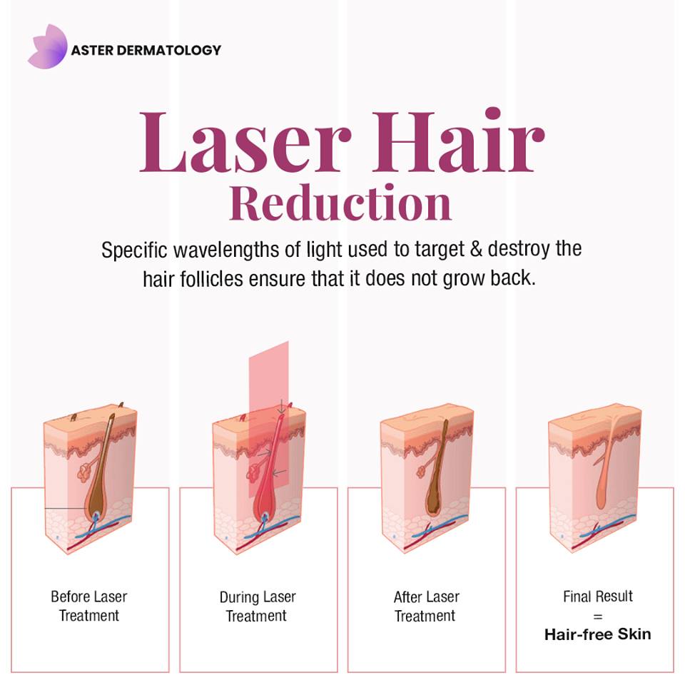 Best Laser Hair Removal Doctor in Gurgaon