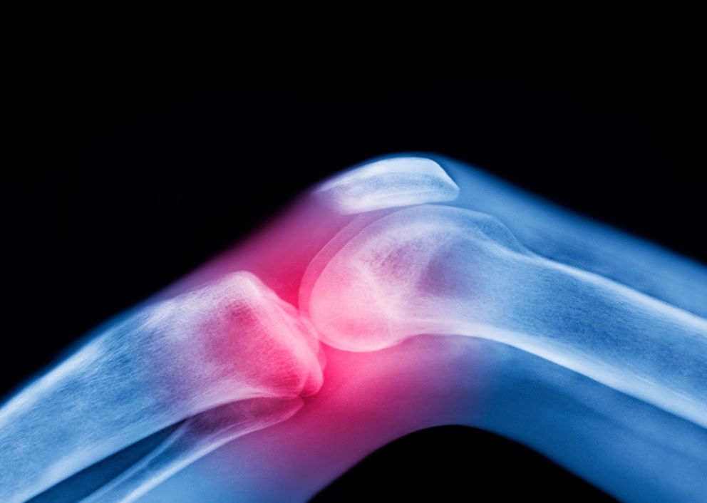 Injury Lawyer in worcester