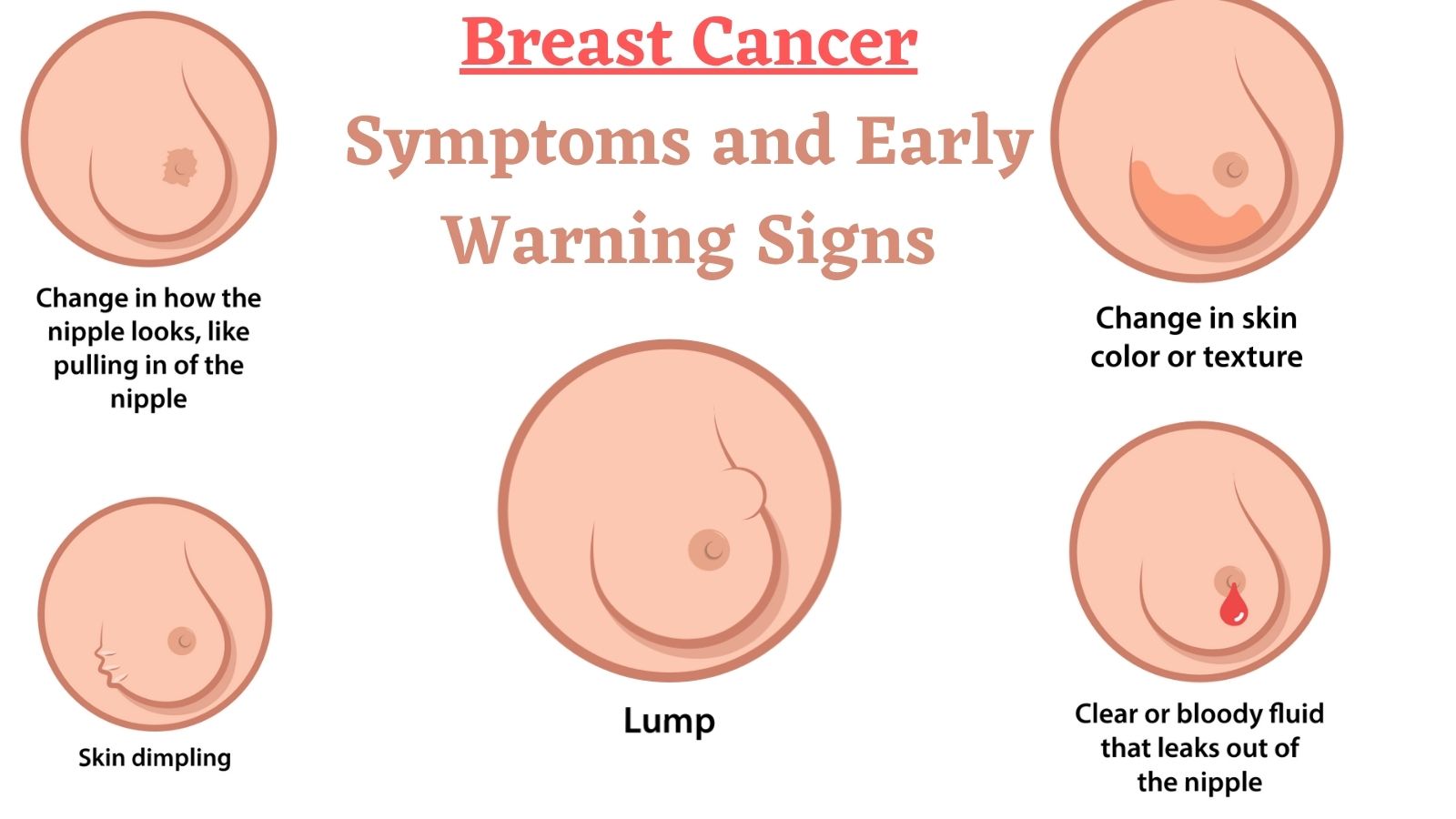Breast Cancer Treatment Medication List