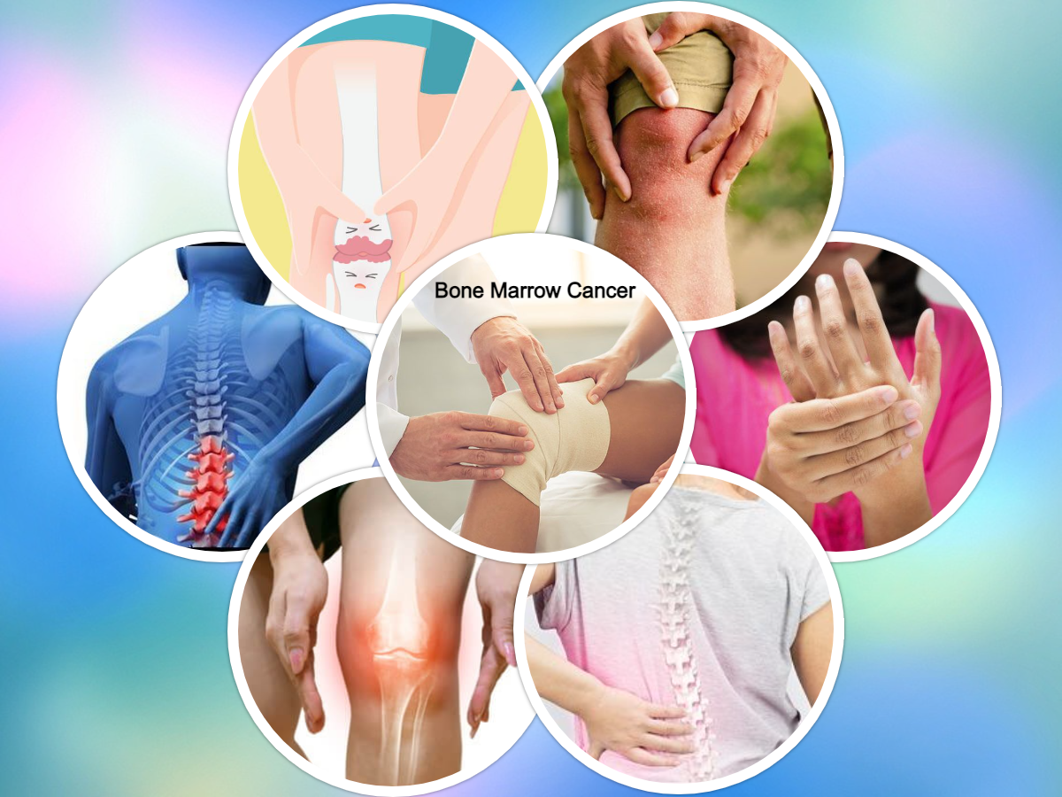 Bone Marrow Cancer Treatment Medication List