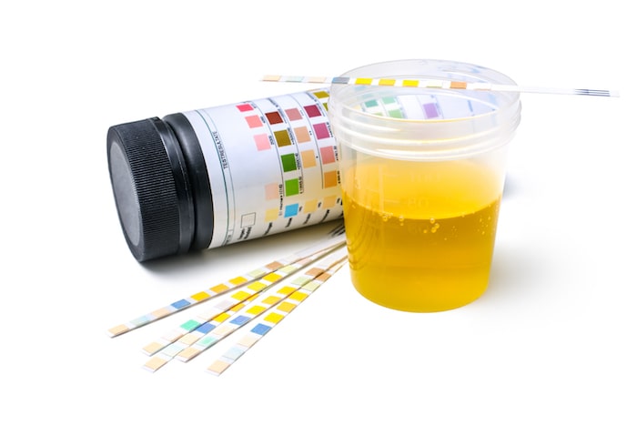 Synthetic Urine Kit: What to Keep In Mind