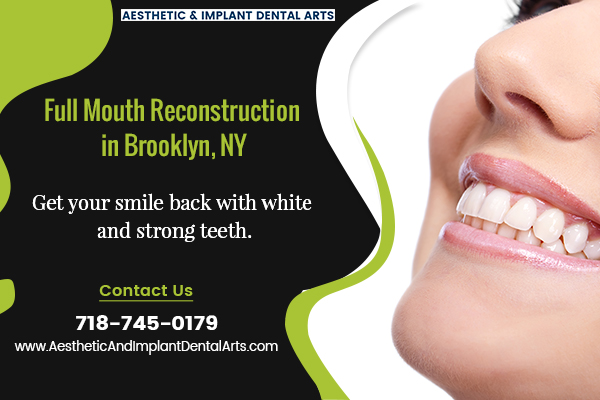 Full Mouth Reconstruction Brooklyn