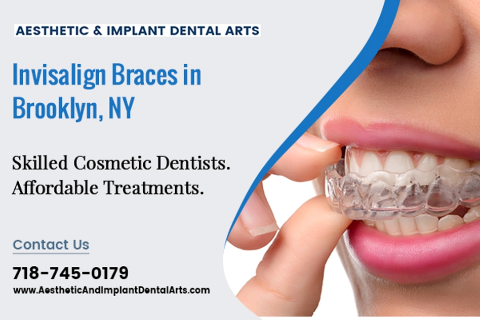 Invisalign Braces Can Steadily Give You A Beautiful Smile