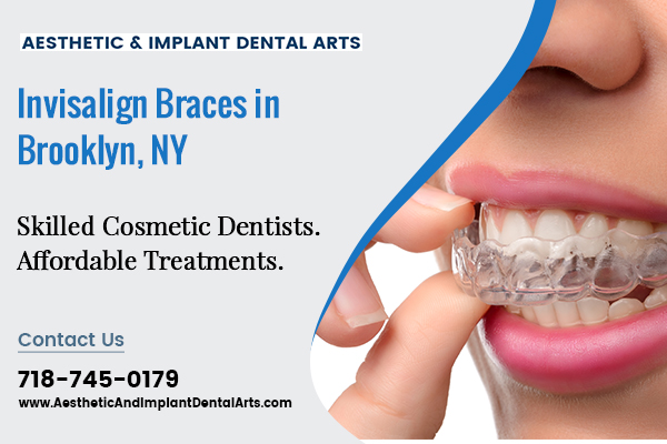 Invisalign braces Brooklyn NY