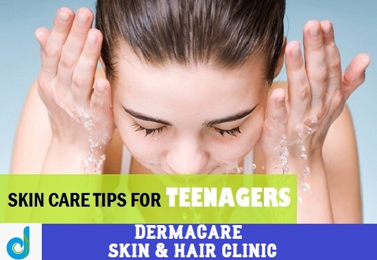 Teenage Skincare Guidelines For Acne and Blackheads