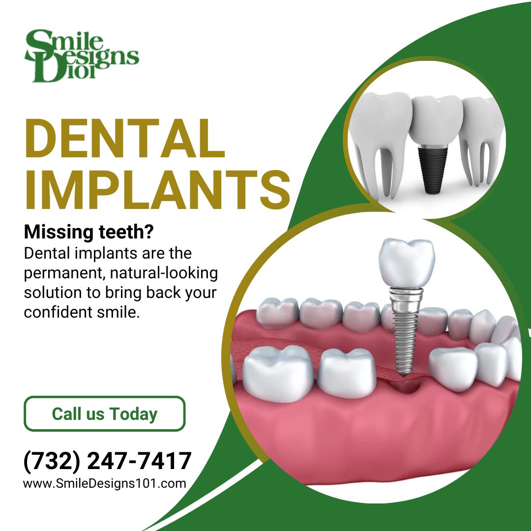 What Is the Downside of Dental Implants?