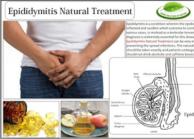 Epididymitis Natural Treatment Stop Further Complications