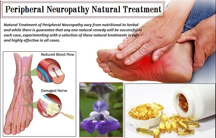 Natural Treatment for Peripheral Neuropathy - Herbs Solutions By Nature