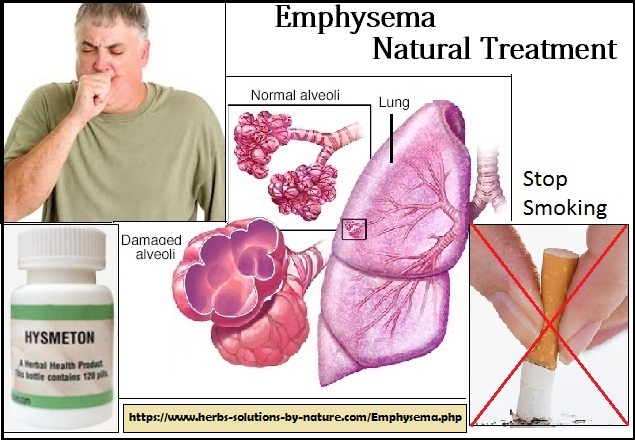 Natural Treatment for Emphysema, Herbs and Natural Essential Oils