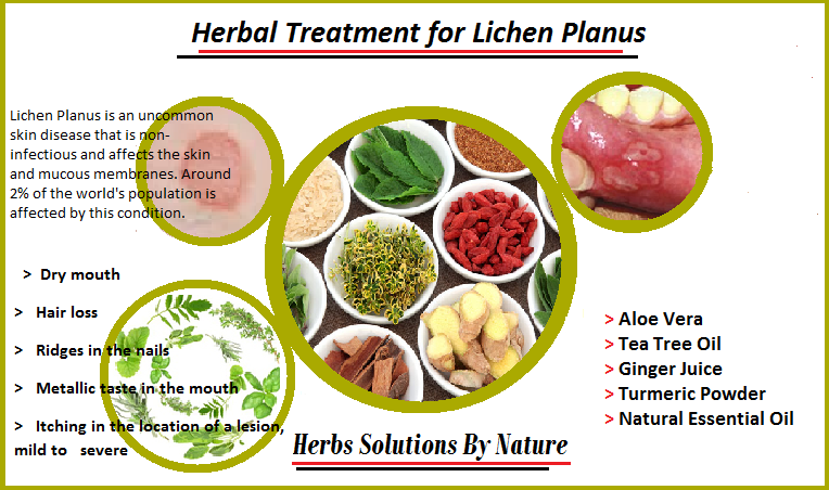 Natural Herbal Treatment for Lichen Planus