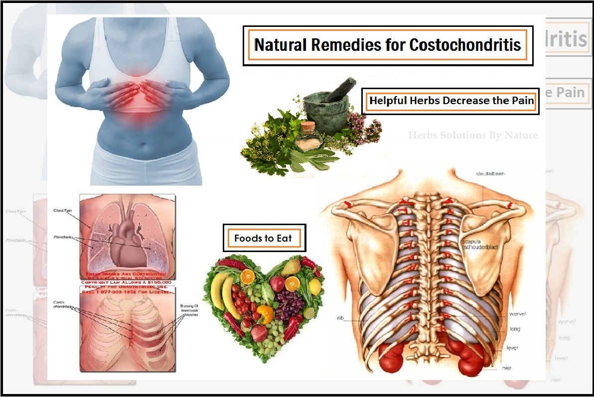 Costochondritis Treatment Natural Remedies Decrease the Pain