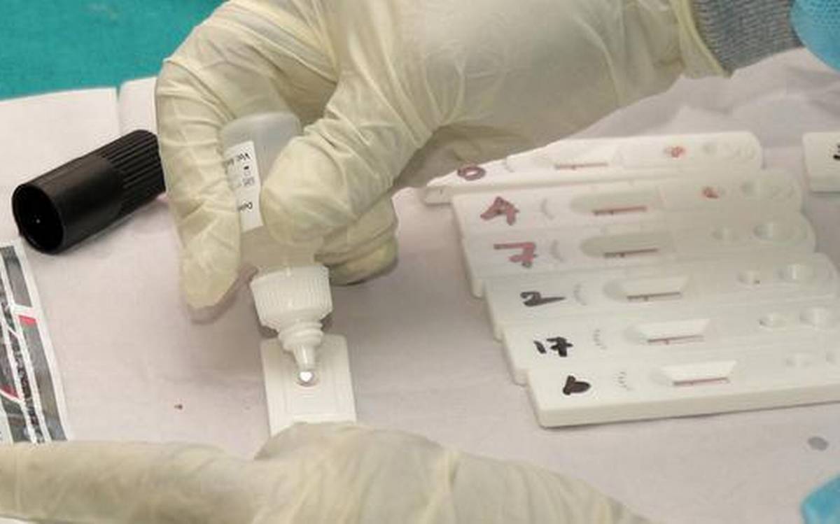 COVID19 Rapid Test Kits Market Global Report 2020-30: COVID 19 Implications And Growth