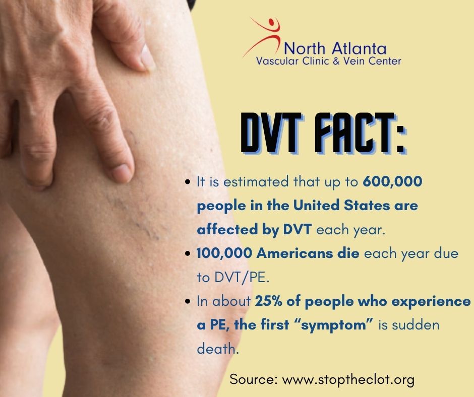 DVT Interesting facts