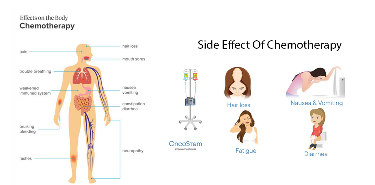 Dos and Don’ts in Chemotherapy | Chemotherapy in Gurugram, Gurgaon, Haryana