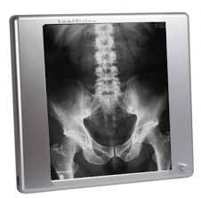 Steps to buy an x-ray machine