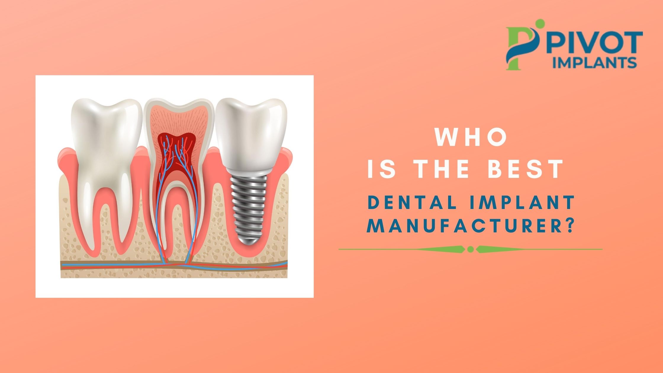 WHO IS THE BEST DENTAL IMPLANT MANUFACTURER?