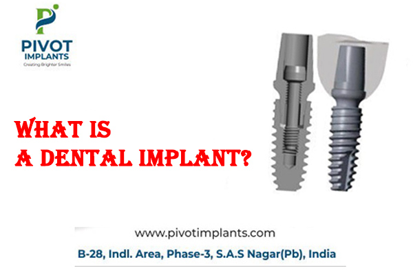 What is Dental Implants