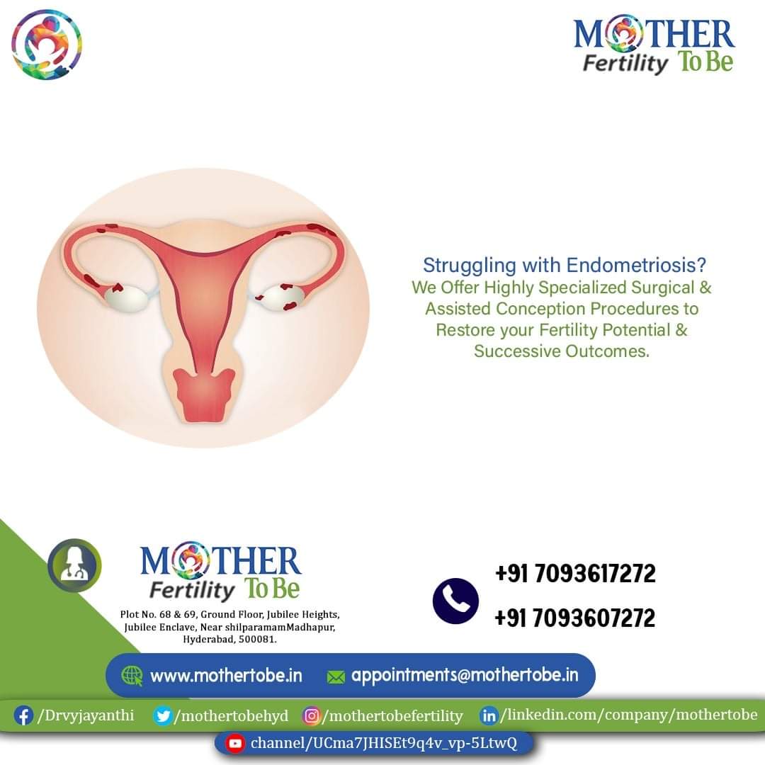 Fertility Treatment for Endometrial Polyps!