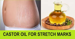 Castor Oil for Stretch Marks - Healthie Genie