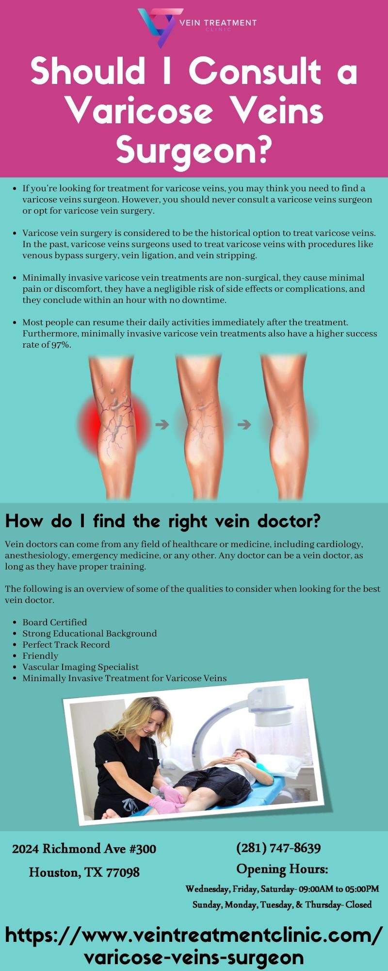 Should I Consult a Varicose Veins Surgeon?