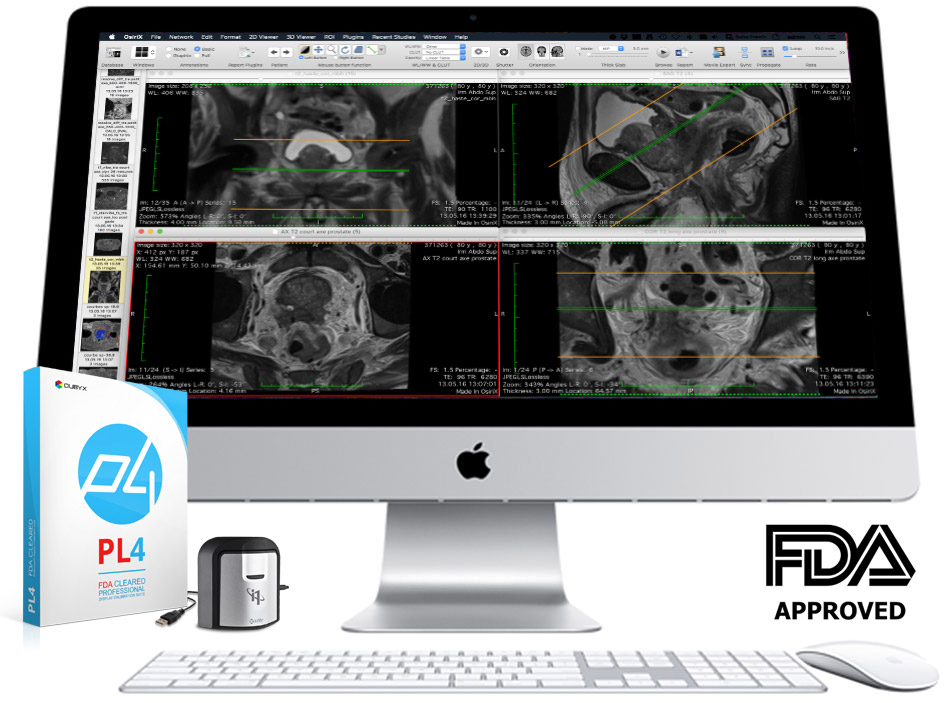 Apple with FDA & DICOM calibration