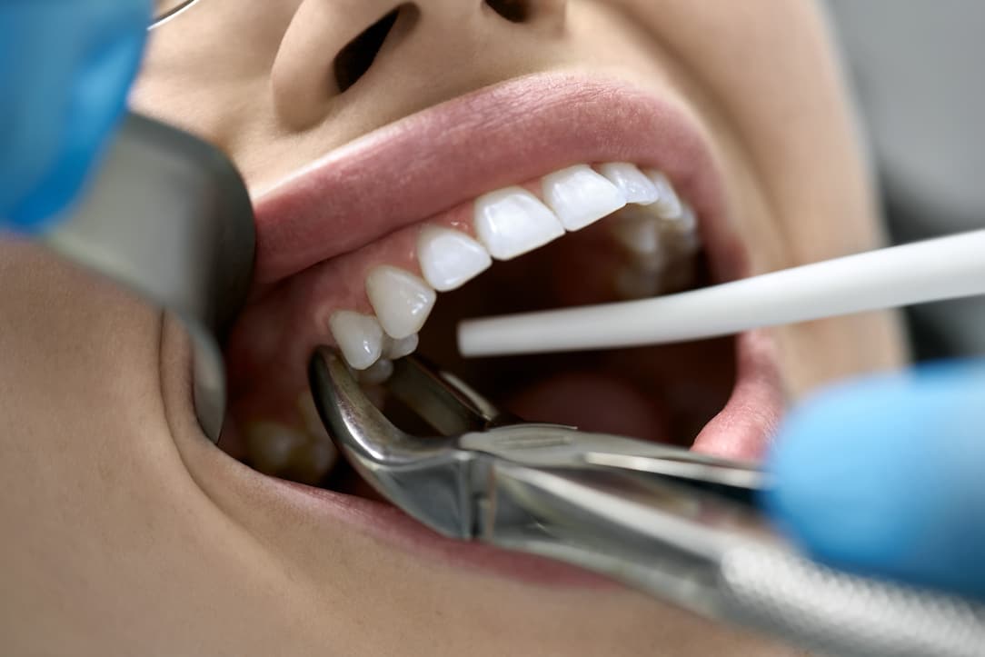 6 Things You Must Know before  going to a South Tampa Dentist.