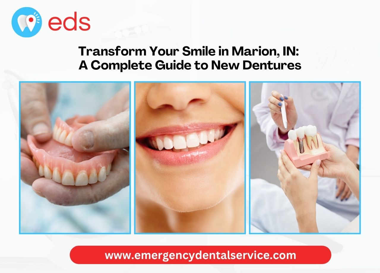 Transform Your Smile in Marion, IN: A Complete Guide to New Dentures